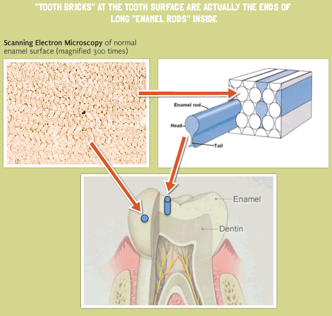 Tooth Bricks at the tooth surface